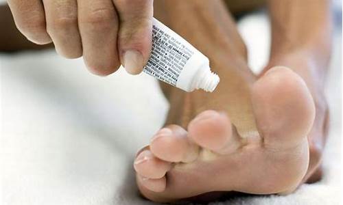 暴力治疗脚气-专治脚气特效药